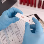Julho Amarelo oferece testagem gratuita para hepatites, HIV e sífilis em Belém – G1