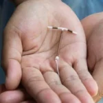 Liberdade contraceptiva, e de graça, pelo SUS, Correio Braziliense reforça
