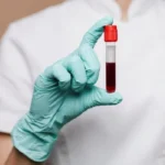 Menos conhecidas, hepatites D e E também circulam no Brasil e preocupam, informa Agência Einstein