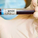Vacinação contra mpox no Brasil: quem tem direito e onde buscar – Correio Braziliense