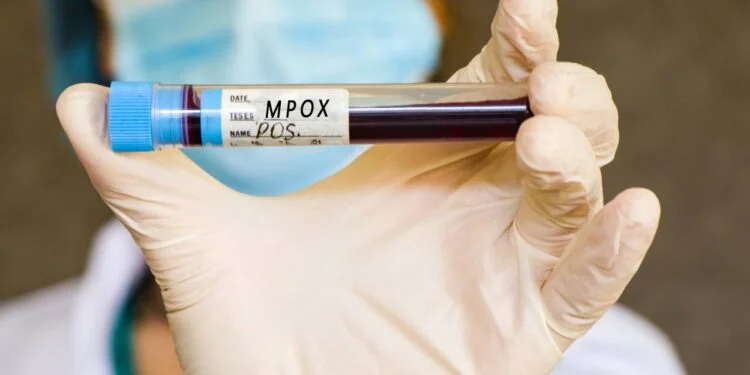 Vacinação contra mpox no Brasil: quem tem direito e onde buscar – Correio Braziliense