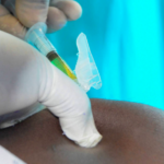 PrEP injetável contra HIV deve ser incorporado ao SUS ainda neste ano, mas com acesso limitado, destaca Folha de S. Paulo