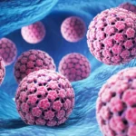 Einstein Hospital Israelita: Como e por que o vírus HPV vira um câncer?