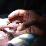 Casos de sífilis congênita sobem 37,5% em Manaus, comunica A Crítica